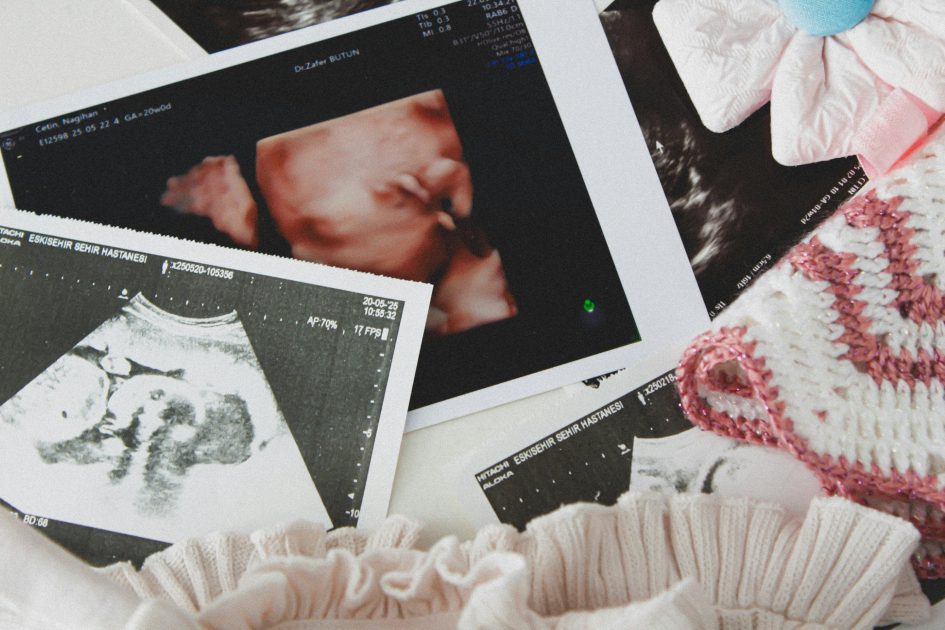 A sonogram surrounded by baby clothes | Image Source: Pexels